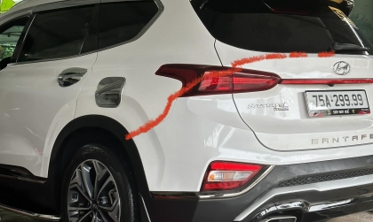 Xe Santa Fe bị lệch sơn thế này, cần tìm cách xử lý