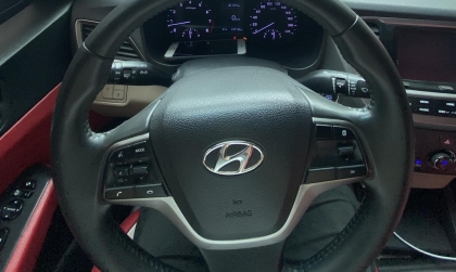 Vô lăng xe Hyundai Accent của em bị lệch đúng không ạ?