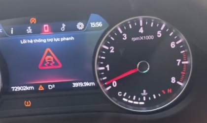 Đồng hồ xe lux a cứ báo lỗi lung tung là sao nhỉ?